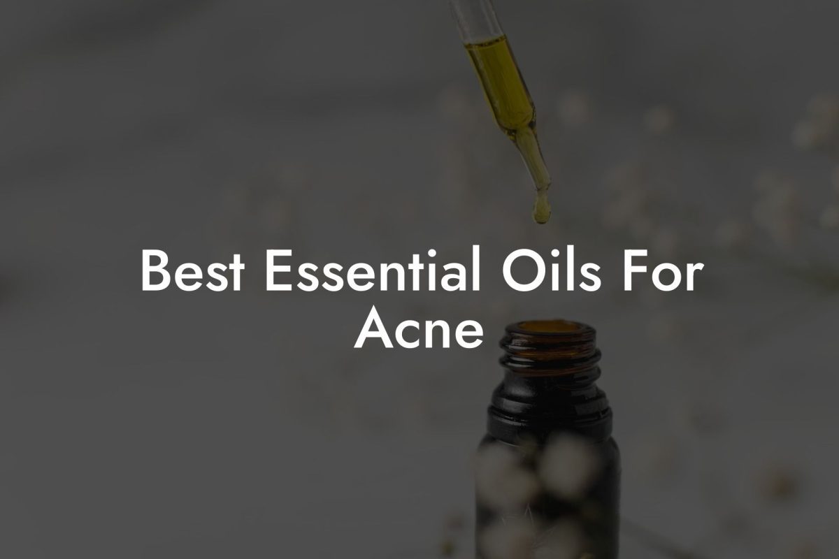 Best Essential Oils For Acne