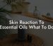Skin Reaction To Essential Oils What To Do